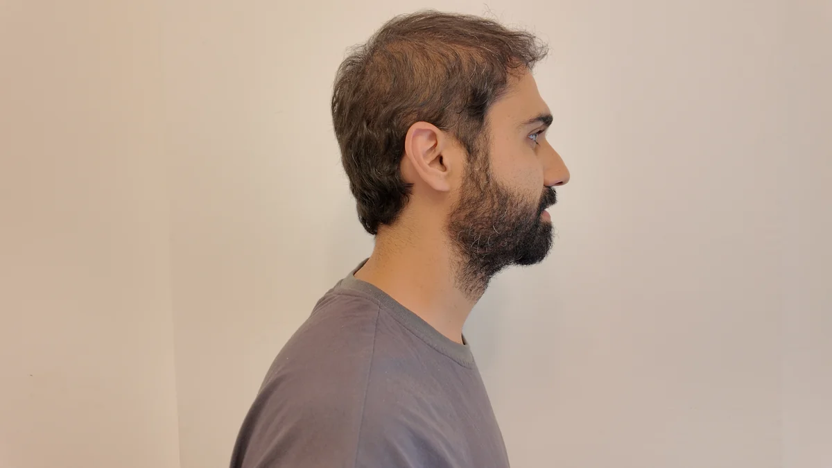 Profile photo: full side view with the ear visible, same shirt and wall.
